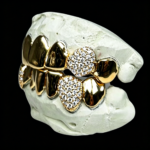 S925 Silver Gold Plated Moissanite Grillz - Half Iced Half Plain Top & Bottom Teeth Grillz - Image 3