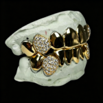 S925 Silver Gold Plated Moissanite Grillz - Half Iced Half Plain Top & Bottom Teeth Grillz - Image 4