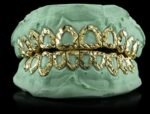SSS Custom Open face plain Solid gold Grillz set S925Filled 14k solid dental gold customized molded ToothGem Oral accessories. - Image 2