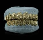 SSS Custom Diamond dust nugget cut Solid gold Grillz setS925 Filled 14k solid dental gold customized moldedTooth Gem Oral accessories. - Image 3