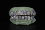 SSS Opal gemstone WVS Moissanite Diamonds ovalPerm/deep cut Icedout diamonds set S925 Filled 14k soliddental gold customized molded Tooth Gem Oralaccessories.