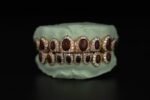 SSS Opal gemstone WVS Moissanite Diamonds ovalPerm/deep cut Icedout diamonds set S925 Filled 14k soliddental gold customized molded Tooth Gem Oralaccessories. - Image 4