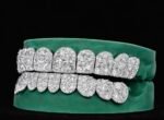 SSS Mosaic Diamonds pointers setting VVS MoissaniteDiamonds Perm/deep cut Icedout diamonds set S925Filled 14k solid dental gold customized molded ToothGem Oral accessories. - Image 4