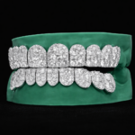 SSS Mosaic Diamonds pointers setting VVS MoissaniteDiamonds Perm/deep cut Icedout diamonds set S925Filled 14k solid dental gold customized molded ToothGem Oral accessories. - Image 3